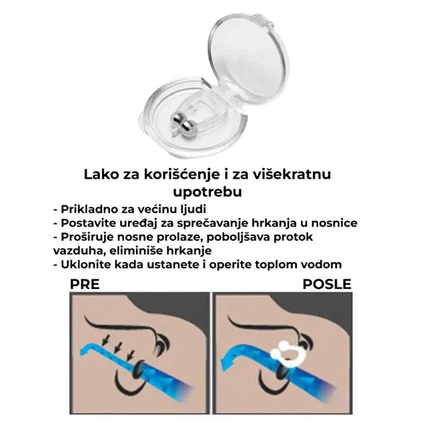 Prsten protiv hrkanja - Set 2 kom.